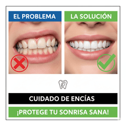Cuidado de Encías: Prevención de la Gingivitis y Periodontitis