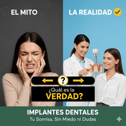 Implantes Dentales: Mitos y Verdades